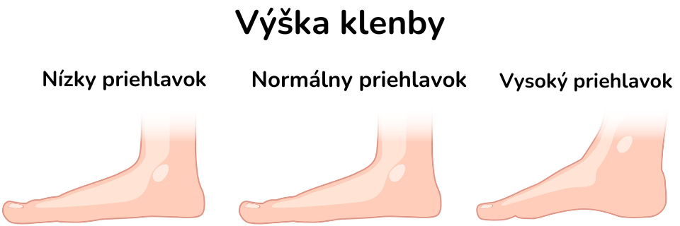 SK  Typy chodidel - výška nártu 2  